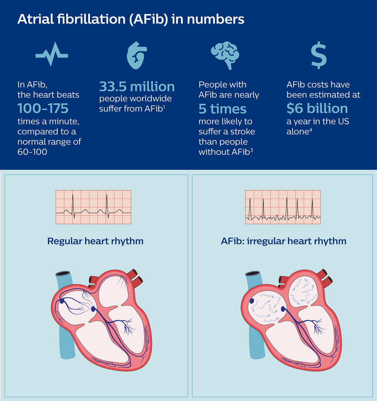 Atrial Fibrillation infographic