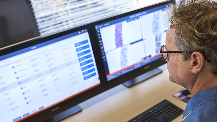 Philips introduces next-generation Digital Pathology Suite &ndash; IntelliSite &ndash; to enhance diagnostic confidence and streamline pathology lab workflows