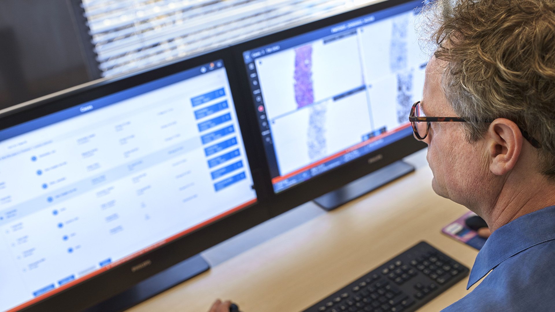 Philips introduces next-generation Digital Pathology Suite &ndash; IntelliSite &ndash; to enhance diagnostic confidence and streamline pathology lab workflows
