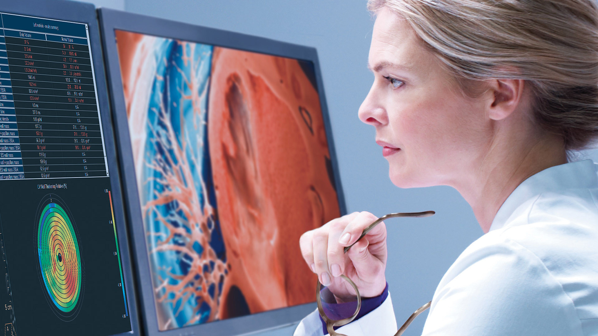 Philips named a Clarivate Top 100 Global Innovator for the 13th consecutive year